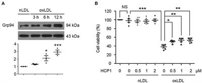 An Inhibitor of Grp94 Inhibits OxLDL-Induced Autophagy and Apoptosis in VECs and Stabilized Atherosclerotic Plaques